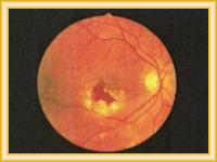 Centros de operacion de ojos con laser.